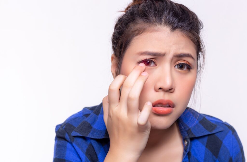 A person with uncomfortable contact lenses adjusts the lens in their right eye.